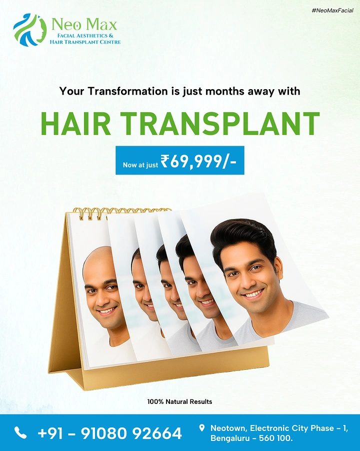 Hair Transplant & Hair Clinics creative ad: Flip calendar shows hair regrowth progression