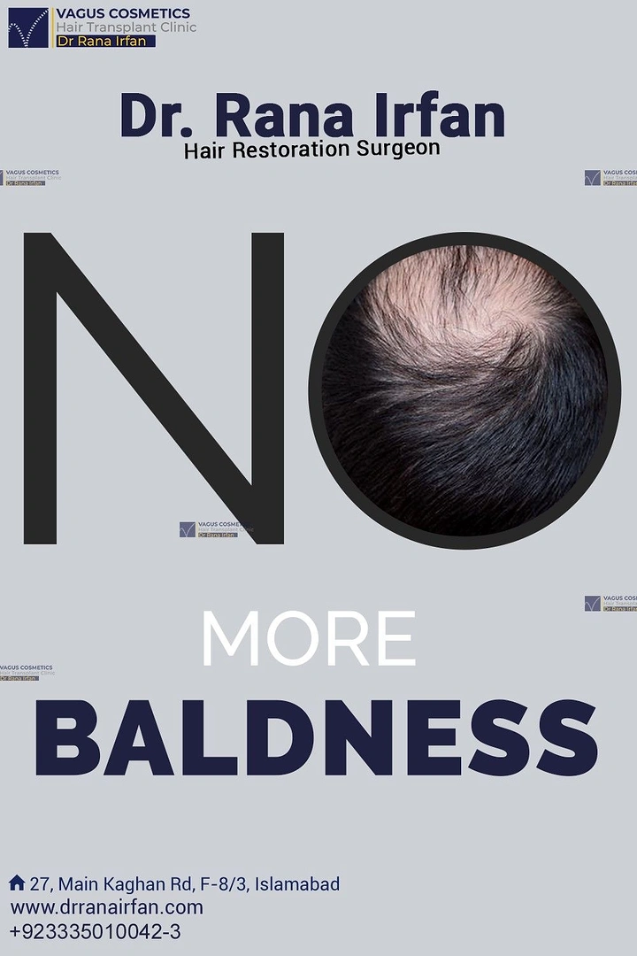 Hair Transplant & Hair Clinics creative ad: Bald scalp forms O in NO