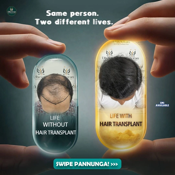 Hair Transplant & Hair Clinics creative ad: Before/after as two pill capsules
